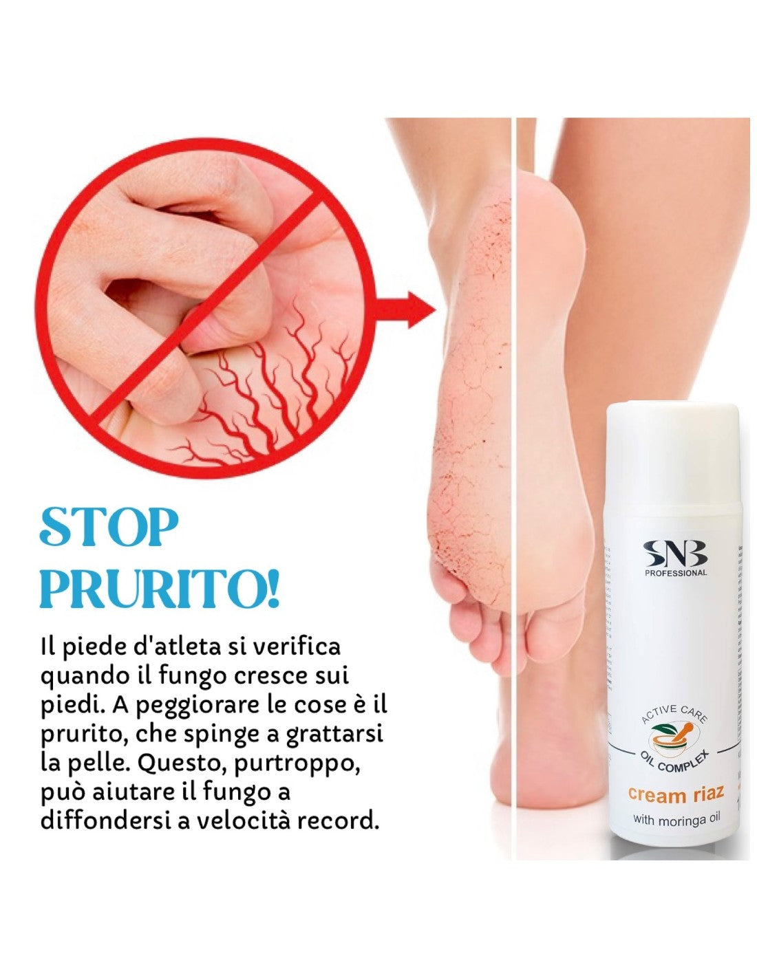SNB Cream Riaz With Moringa Oil Per Irritazioni E Prurito - 100 ml